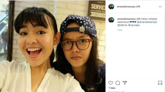 Amanda Manopo sebelum dan sesudah perawatan [Instagram]