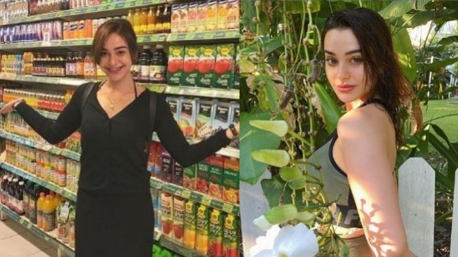 Gemes! Nora Alexandra Pamer Foto Sebelum Operasi Payudara, Begini Bentuknya