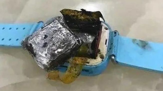 Smartwatch terbakar. [Yahoo/Asiawire]