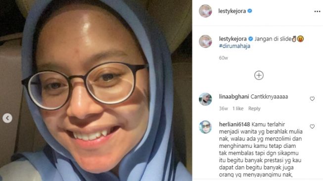 Potret Lesti Kejora jerawatan [Instagram]