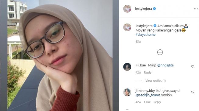 Potret Lesti Kejora jerawatan [Instagram]