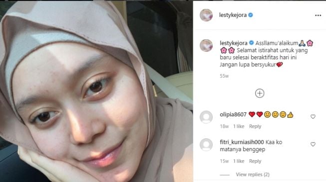 Potret Lesti Kejora jerawatan [Instagram]