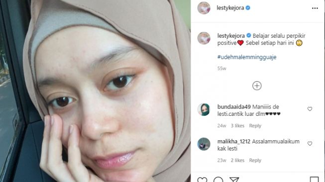 Potret Lesti Kejora jerawatan [Instagram]