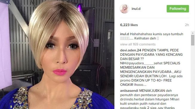 Artis Cantik Berkumis Tipis (Instagram/@inul.d)