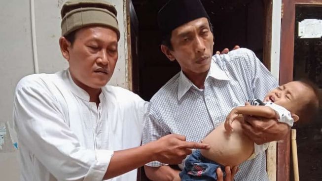 Tolong Bupati Pandeglang Irna Narulita! Bayi 11 Bulan di Cisata Idap Tumor Butuh Bantuan