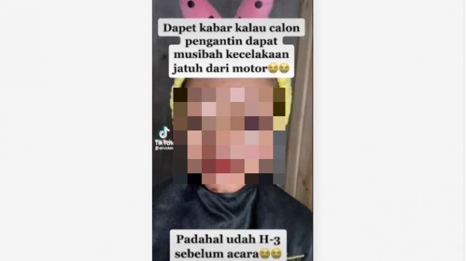 MUA Rias Pengantin Habis Kecelakaan Lukanya Belum Kering, Tak Disangka Hasilnya Memukau