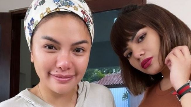 Tantang Nikita Mirzani Adu Jotos, Dinar Candy Dapat Dukungan Netizen