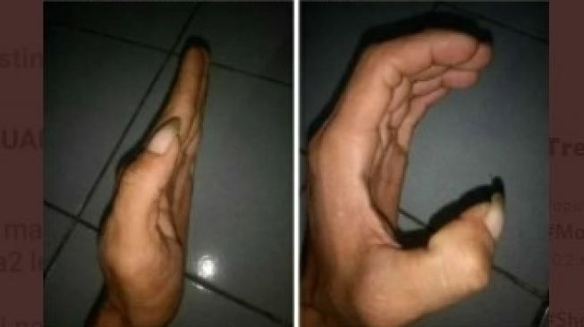 Jual HP bekas, wujudnya bikin ngakak (Twitter)