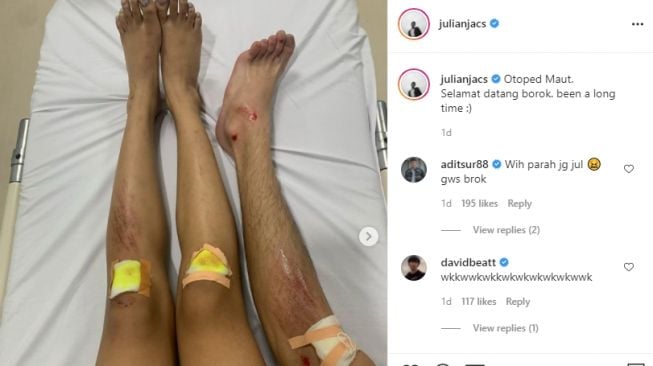 Potret kondisi Julian Jacob dan Brisia Jodie setelah kecelakaan [Instagram]