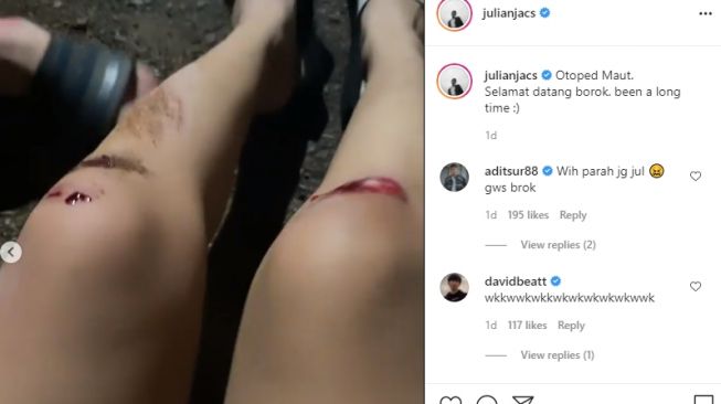 Potret kondisi Julian Jacob dan Brisia Jodie setelah kecelakaan [Instagram]