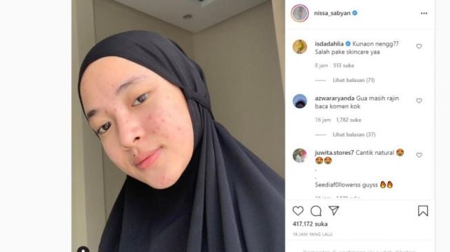 Muncul Tanpa Makeup, Wajah Berjerawat Nissa Sabyan Jadi Sorotan