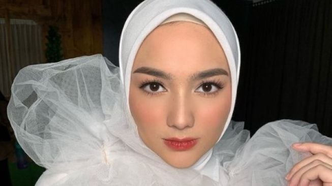 Artis turunkan berat badan secara drastis. (Instagram/citraciki)