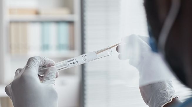 Ini Alasan Pemerintah Baru Turunkan Harga Tes Swab PCR
