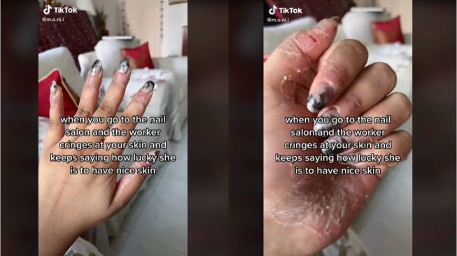 Curhat Wanita Dipermalukan saat Manikur karena Kulit Pecah-pecah (tiktok.com/@m.o.ni.i)