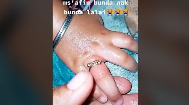 Ibu syok lihat jari tangan anaknya (tiktok)