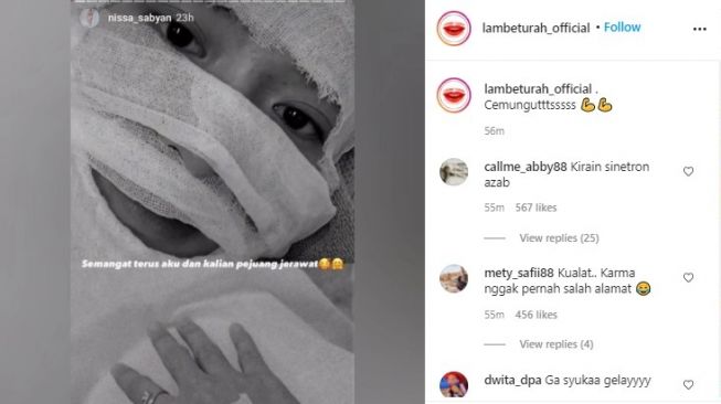 Seluruh Wajah Nissa Sabyan Diperban Akibat Jerawat, Netizen: Kirain Sinetron Azab