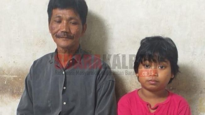 Kehilangan Sebelah Penglihatan, Ayu di Sungai Kunyit Susah untuk Belajar