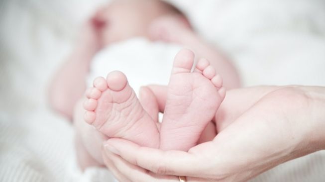 Bayi Kembar Siam Tiga Kaki Lahir di Asahan, Dirujuk ke RSUP Adam Malik