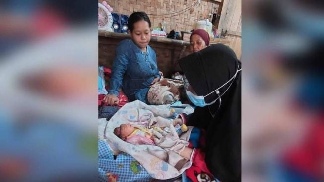 Bayi Lahir Tanpa Tempurung di Sukabumi, Ternyata Sudah Ada Tiga Kasus