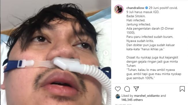 Chandra Liow bercerita saat terinfeksi corona hingga terkena badai sitokin [Instagram/@chandraliow]