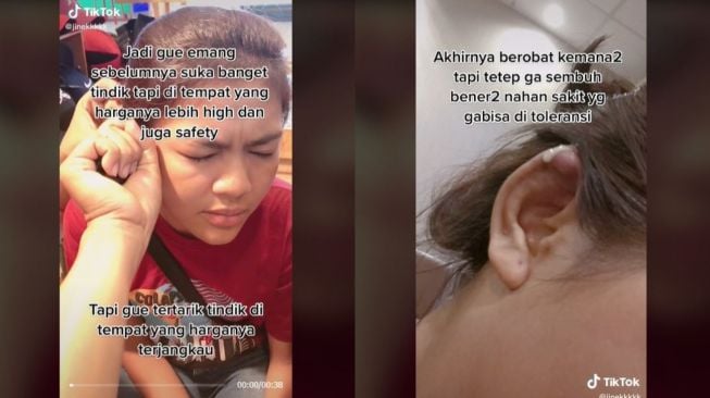 Curhat Wanita Tindik di Tempat Murah, Berakhir Bengkak dan Bernanah (tiktok.com/@jinekkkkk)