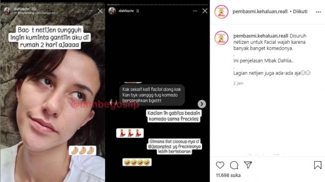 Wajah Dahlia Poland kembali jadi bahan cibiran netizen (instagram.com)