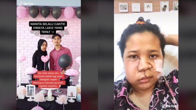 Curhat Wanita Sakit hingga Operasi Wajah, Pacar Setia Menemani (tiktok.com/@rhmiipm)