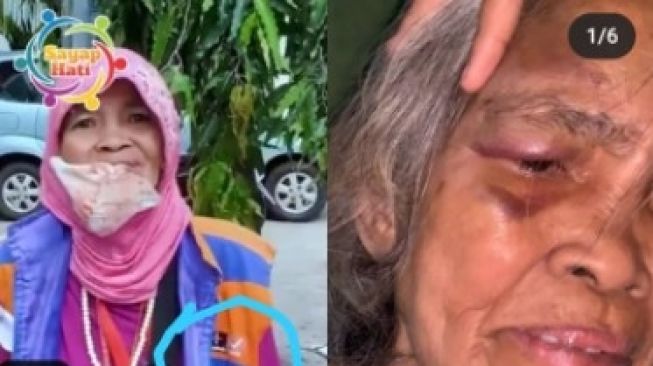 Nenek Juru Parkir di Kota Makassar Dipukul dan Ditendang Preman, Begini Kondisinya