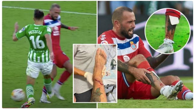 Potret Cedera Mengerikan Aleix Vidal karena Pakai Deker dari Karton, Kulit Kaki Sobek