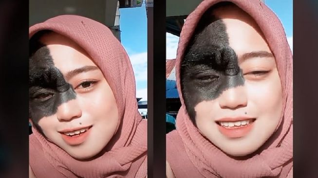 Viral Ika Masriana, TikTokers Punya Tanda Hitam di Wajah Dibully Mirip Monyet