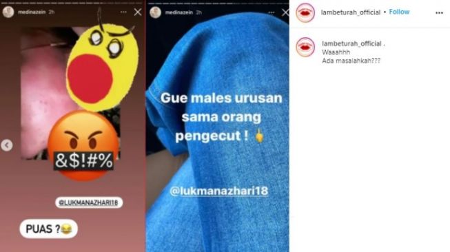 Medina Zein pamer wajah lebam dan sebut suami pengecut. (Instagram/@lambeturah_official)