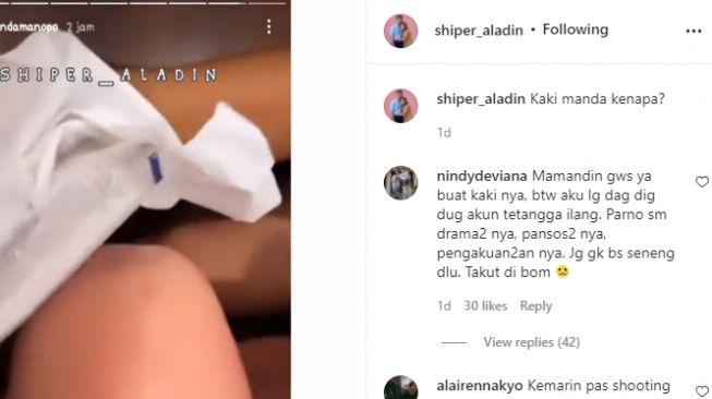 Kondisi kaki Amanda Manopo yang sakit [Instagram/@shiper_aladin]