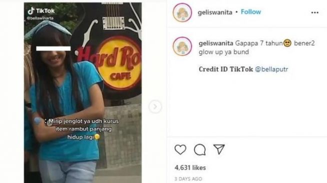 Kerap Diejek Jelek, Transformasi Gadis Ini Selama 7 Tahun Tuai Pujian Netizen