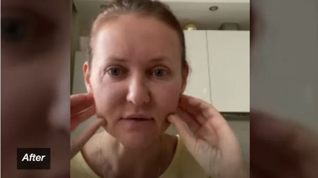 Perawatan Kecantikan, Wajah Wanita Ini Terlihat 10 Tahun Lebih Tua (youtube.com/Video Desk)