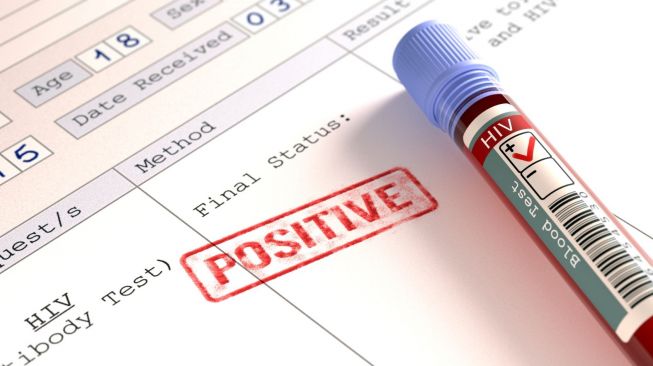 Banyuwangi Catat 286 Kasus HIV/AIDS Sepanjang 2021