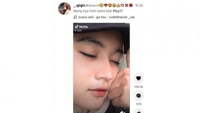 Viral, Gadis Cantik Pamer Foto saat Kecil, Netizen: Perubahan yang Sangat Memuaskan