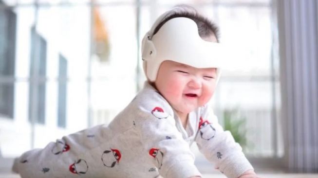 Viral! Orangtua Di China Pakaikan Anak Helm Agar Kepalanya Bulat Sempurna