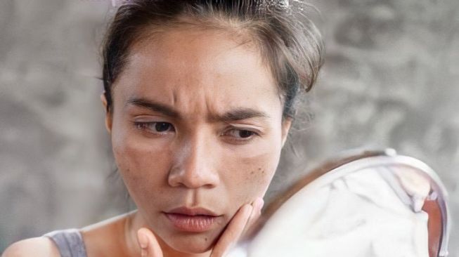 Jarang diketahui, Ternyata Flek Hitam dan Freckles Berbeda
