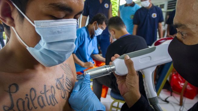 Warga binaan menjalani proses penghapusan tato menggunakan sinar laser di Lapas Kelas II A, Karawang, Jawa Barat, Rabu (10/11/2021). ANTARA FOTO/M Ibnu Chazar