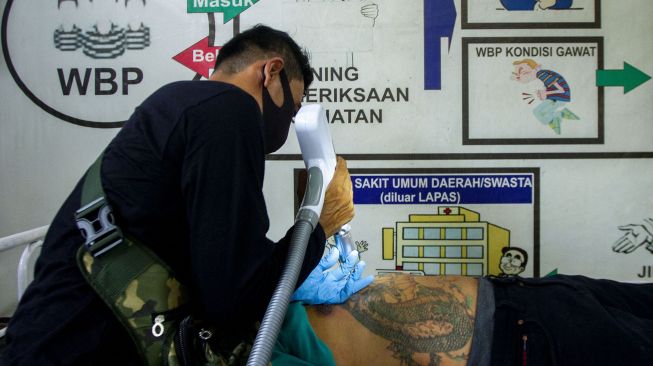 Narapidana menjalani proses penghapusan tato menggunakan sinar laser di Lapas Kelas II A, Karawang, Jawa Barat, Rabu (10/11/2021). ANTARA FOTO/M Ibnu Chazar