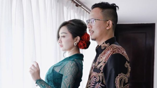 Resmi Dilamar Pengusaha, Cupi Cupita Kini Sudah Ada yang Punya