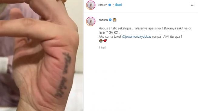 Ratu Rizky Nabila hapus tato. (Instagram/@raturn)