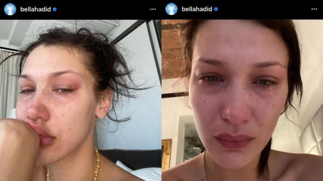 Bella Hadid Unggah Selfie Menangis (Instagram bellahadid)