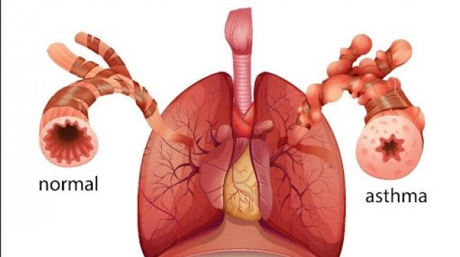 Fungsi Alveolus, Kantong Udara Kecil dalam Tubuh Serta Risiko Penyakit yang Mengintainya
