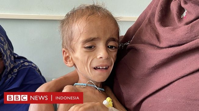 Bayi-bayi Afghanistan Kelaparan, RS Kesulitan, Rasanya seperti di Neraka