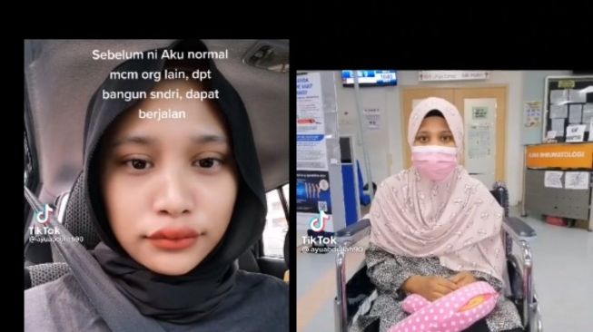 Perempuan Ini Alami Penyakit Sendi Parah, Sampai Berobat ke Dokter dan Orang Pintar