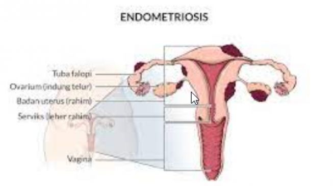 Fungsi Endometrium: Perannya Sangat Penting dalam Sistem Reproduksi Wanita