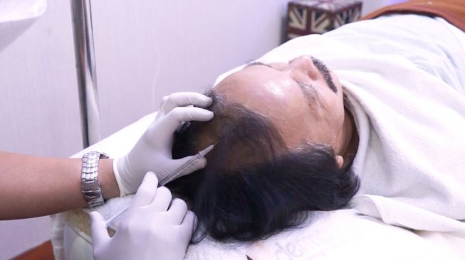 Caca Handika menjalani treatment Hair Growth Cell untuk mengatasi malasah kebotakan pada rambut. [Dermapro]