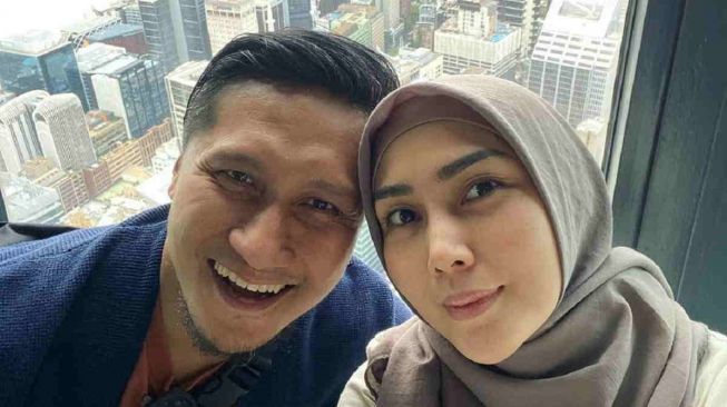 Anak Arie Untung Sakit dan Khitan Sekalian Demi Kesehatan, Sakit Apa?