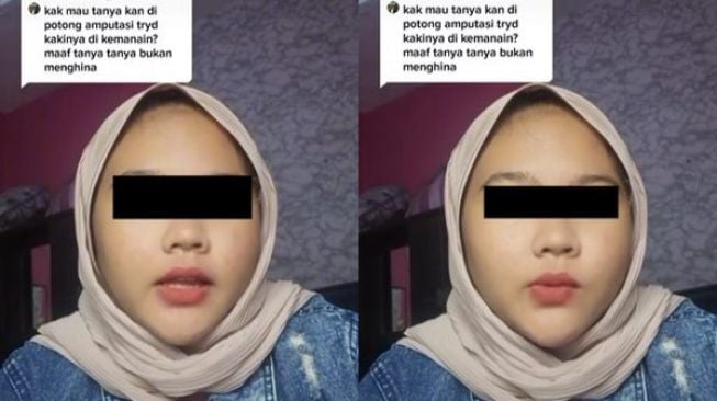 Viral Cewek Cerita Pilu Nasib Kakinya Setelah Diamputasi Dibawa Ayah